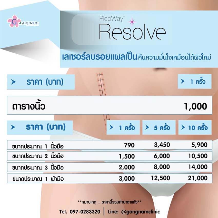 เลเซอร์รอยแตกลาย - Gangnamlaser Clinic