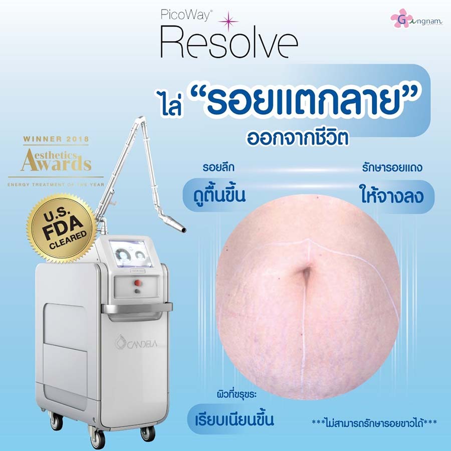 เลเซอร์รอยแตกลาย - Gangnamlaser Clinic